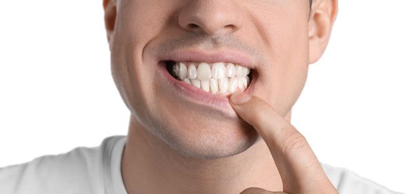 Diş Eti Çekilmesi Nedir ve Hangi Vitamin Eksikliğinden Kaynaklanır?