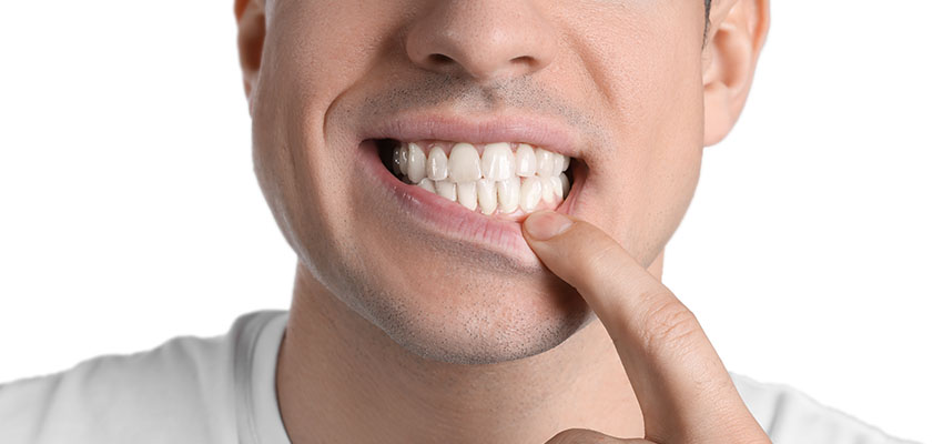Diş Eti Çekilmesi Nedir ve Hangi Vitamin Eksikliğinden Kaynaklanır?